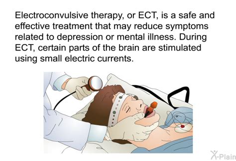 electric box test depression|electroconvulsive therapy for mental health.